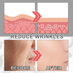 Nti-aging Marine Collagène Visage Corps Blanchiment Recombinaison Resserre la Peau Éclaircit les Ridules Hydrate Crème Anti-rides - Product Image 4