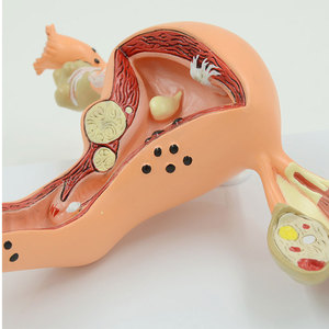 แบบจำลองกายวิภาคศาสตร์สตรี สำหรับการสอนด้านนรีเวชวิทยา แสดงการเปลี่ยนแปลงของมดลูก ทำจากพีวีซี - Product Image 3