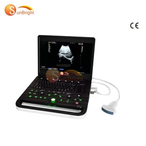 Mesin USG Digital Portabel SUN-800C untuk Kehamilan, Rumah Sakit, dan Ekokardiografi - Product Image 1