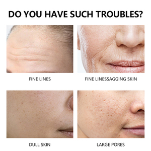 Fórmula de gel de crema facial de vitamina B3 y vitamina E de Aloe <span class=keywords><strong>Vera</strong></span> de etiqueta privada para la reducción de la hiperpigmentación y el brillo de la piel - Product Image 4