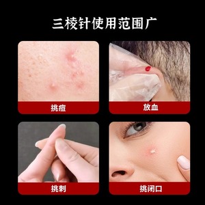 Disposable Triangular Needle Stainless Steel For Acne Picking Bloodletting And Stasis Removal With Individual Packaging - Product Image 1