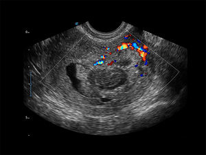 X3 Sonosape Mesin Elektrokardiografi Portabel Harga Doppler Cembung Linier Transduser Jantung - Product Image 4
