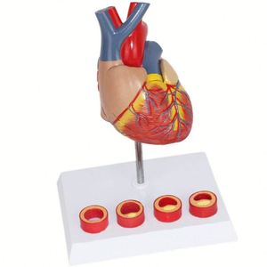 Modelo de corazón KyrenMed corazón con modelo de trombo - Product Image 4
