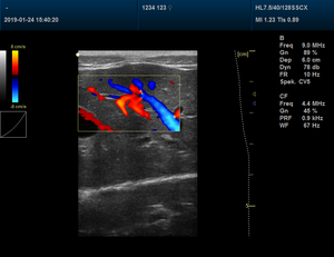 Mejor <span class=keywords><strong>Precio</strong></span> Veterinario Portátil Doppler Veterinario Ultrasonografía Veterinaria Máquina de Ultrasonido - Product Image 2