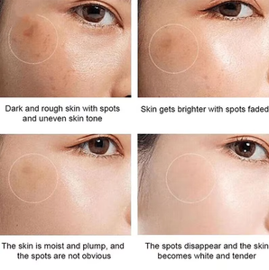 Crème éclaircissante et anti-taches à base de plantes du Yunnan, capable d'éclaircir le mélasma, les taches solaires, les cicatrices d'acné, la peau terne et de redonner de l'éclat à la peau - Product Image 5