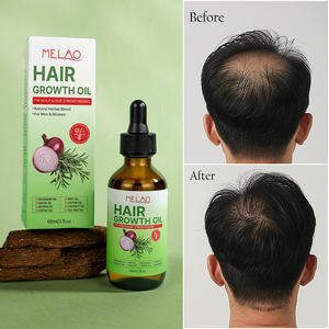 Formule personnalisée, mélange d'herbes naturelles, texture douce, huile de soin, HUILE DE CROISSANCE CAPILLAIRE pour les soins quotidiens - Product Image 4