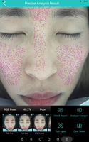 Machine d'analyse intelligente de la peau du visage avec caméra HD 16MP, numérisation rapide en 20 secondes, rapport de comparaison avant-après, exportation PDF