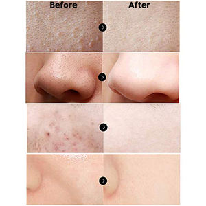 Sérum de cellules souches de pomme de réparation de peau de rides bio et naturel de marque privée - Product Image 5