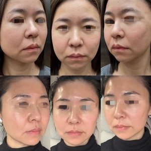 Suero Facial Pink Glow Skin Booster Antiarrugas y Reafirmante con VB12, 135 ha, Complejo Polirevitalizante en Ampollas - Product Image 3