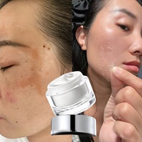 Crème pour le visage à base de bactéries lactiques anti-mélasma et anti-taches, enrichie en vitamines C et E, éliminateur de pigmentation et de taches noires, peeling chimique