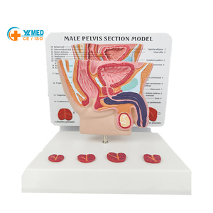 Modelo Anatómico de Pelvis Masculina Humana con Enfermedad Sagital en 4 Etapas, Anatomía de la Cavidad Pélvica, Ciencia Médica - Product Image 1
