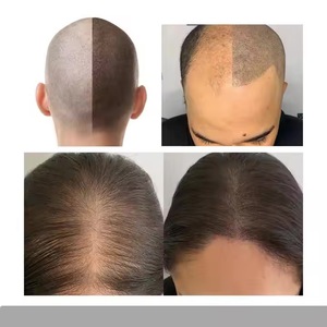 Tinta de tatuaje SMP de etiqueta privada, pigmentos Pmu, tinta de <span class=keywords><strong>micropigmentación</strong></span> del cuero cabelludo de 1000ml para folículos pilosos - Product Image 6