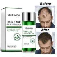 Huile essentielle de croissance des cheveux au gingembre, sérum de traitement naturel biologique Anti-chute des cheveux