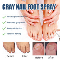 Formule végétale OEM 30ml traitement soulageant les ongles gris soulagement apaisant ongles bio rapide huile d'arbre à thé anti-démangeaisons gris ongle pied spray