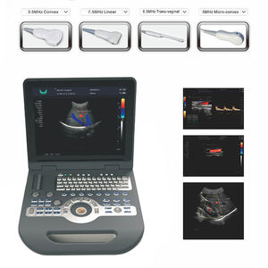 LTUB65 - Escáner de Ultrasonido Portátil a Color de Bajo <span class=keywords><strong>Precio</strong></span>, Sistema de Diagnóstico Médico, Máquina de Ecocardiografía - Product Image 4