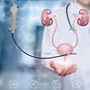 Cistoscopio Médico Desechable Haiye para el Diagnóstico de <span class=keywords><strong>Enfermedades</strong></span> Urológicas Humanas y Uso en Tratamiento Local de Pelvis - Product Image 3