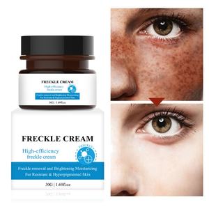 Crema Facial Hidratante y Aclarante para el Cuidado de la Piel, Elimina Pecas, 30g, Venta al Por Mayor - Product Image 1