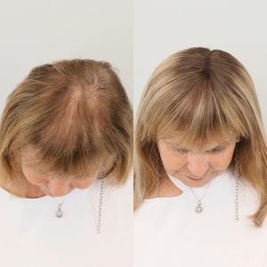 شعر مستعار أوروبي ريمي عذراء، قطعة علوية كبيرة الحجم 10x10 بدانتيل أمامي، قطع شعر علوية من شعر بشري طبيعي كامل الكثافة للنساء - Product Image 6