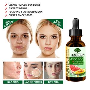 ผลิตภัณฑ์ที่ดีที่สุดในการขายฉลากส่วนตัวต่อต้านริ้วรอยวิตามินซีเซรั่มกรดไฮยาลูโรเรตินสำหรับผิวไวท์เทนนิ่งดูแลสีดำสีเขียว OEM - Product Image 5