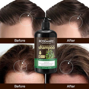 زيت نباتي عضوي مخصص طبيعي مضاد للتساقط لنمو الشعر مستخلصات زيوت الشعر من نبات روزماري النعناع شامبو و بلسم للشعر - Product Image 5