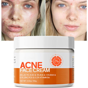 <span class=keywords><strong>ครีม</strong></span>ทาหน้ารักษาสิวต่อต้านสิวที่ทำให้ผิวสดชื่นควบคุมความมันให้ความชุ่มชื้นจางลง<span class=keywords><strong>ครีม</strong></span><span class=keywords><strong>ลด</strong></span><span class=keywords><strong>สิว</strong></span>รอย<span class=keywords><strong>แดง</strong></span>บนใบหน้า - Product Image 6