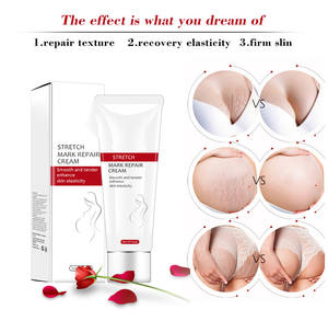 Jiajie özel etiket toptan yumuşak Stingless kremi masaj streç işareti onarım kremi - Product Image 4