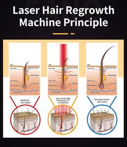 Máquina Profesional Taibo para el Crecimiento del Cabello, Detiene la Caída del Cabello, Terapia de Rejuvenecimiento del Cuero Cabelludo, Masajeador de Cuero Cabelludo con Fotones de 650nm, Máquina para el Recrecimiento del Cabello - Product Image 3