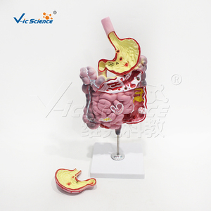 Modelo <span class=keywords><strong>de</strong></span> Simulación <span class=keywords><strong>de</strong></span> Enfermedades del Sistema Digestivo - Modelo Anatómico <span class=keywords><strong>de</strong></span> Ciencias Médicas para Entrenamiento en Escuelas <span class=keywords><strong>de</strong></span> Medicina Vic Science Model - Product Image 3