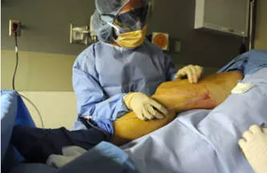 EVLT/EVLA 1470nm 980nm Diodelaserapparaat voor minimaal invasieve endovenuze variceschirurgie - Product Image 4