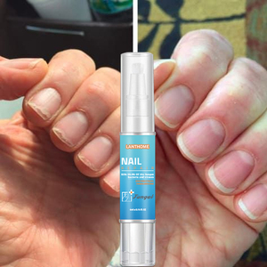 <span class=keywords><strong>Lanthome</strong></span> – Stylo de Traitement Antifongique pour Ongles, 4 ml, à Base de Plantes, pour Soin des Ongles et Traitement des Mycoses des Ongles des Pieds – Vente en Gros - Product Image 1