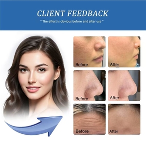 Potente Máquina Facial Hidratante que Retiene la Humedad de la Piel para una Textura Suave y Duradera - Product Image 4