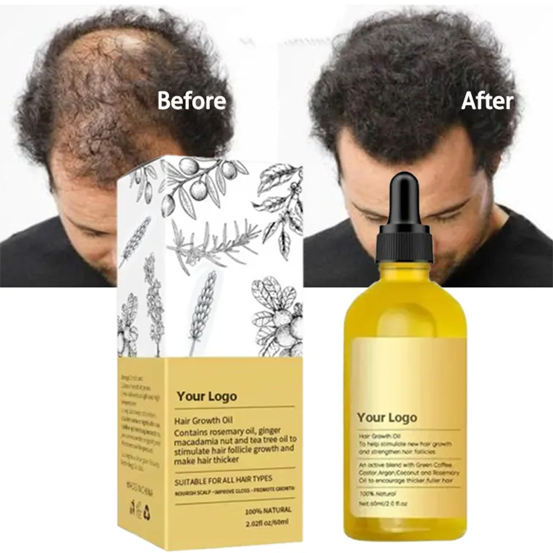 Private Label 100 Natural Organic Scalp