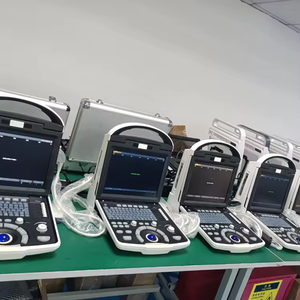 Escáner de <span class=keywords><strong>ecocardiograma</strong></span> cardíaco portátil mejor calificado Sistema de ultrasonido <span class=keywords><strong>Doppler</strong></span> a color digital completo - Product Image 6