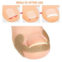 Patch de Correction d'Ongles Professionnel Portable Auto-Adhésif Sans Colle pour Soins des Pieds, Outils de Pédicure, Réduit la Douleur et la Pression, Boîte à Ongles