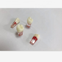 Modèle de dents dentaires avec canal radiculaire à des fins médicales