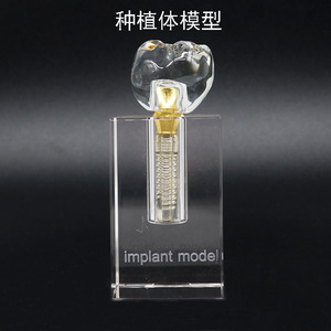 Dental Implant <b>Model</b> 2x Detachable Teaching Anatomical <b>Medical</b> Silicone For Dental Education - Product Image 5