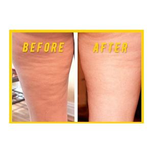 Chine 100% pur à base de plantes essentiel bon effet graisse réduire l'<span class=keywords><strong>huile</strong></span> corporelle naturelle <span class=keywords><strong>huile</strong></span> de massage anti-<span class=keywords><strong>cellulite</strong></span> - Product Image 5