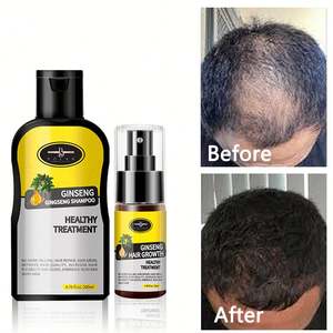 Essence Spray <span class=keywords><strong>2022</strong></span> pour la croissance des cheveux, <span class=keywords><strong>meilleur</strong></span> traitement de la calvitie, réparation contre la perte de chevelure, pour femmes - Product Image 4