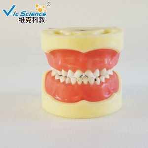 Modèle de dents humaines fournitures dentaires modèle manquant de dents avec 32 pièces/ensemble modèle d'éducation des sciences médicales - Product Image 6