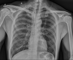 Проводной детектор <span class=keywords><strong>DR</strong></span> Xray плоская панель для медицинского рентгеновского радиационного оборудования - Product Image 5