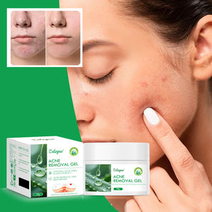 Crema Hidratante de <span class=keywords><strong>Aloe</strong></span> <span class=keywords><strong>Vera</strong></span> Natural Zaleyae, Desvanece Manchas, Antiacné, Reduce Poros, Nutre, Repara, Rejuvenece, Gel para el Cuidado Facial - Product Image 2