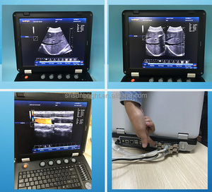 Appareil d'échographie cardiaque <span class=keywords><strong>portable</strong></span> CE, échographie 2D, échographie cardiaque 3D, échographie <span class=keywords><strong>Doppler</strong></span> couleur - Product Image 3