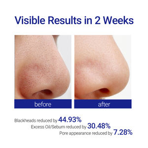 Discos Faciales Coreanos para el Cuidado de la Piel, Exfoliantes, Reductores de Poros, con Ácido Láctico AHA y Ácido Salicílico BHA, para Todo Tipo de Piel - Product Image 2