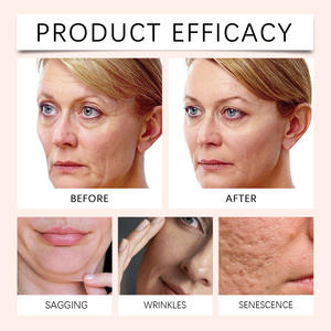 Hoygi Centella Clay Mask Stick Hydratant Hydratant pour un soulagement apaisant de la peau du visage inconfortable - Product Image 5