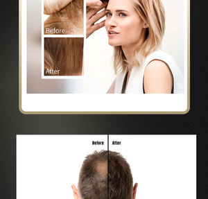 Spray para el Crecimiento del Cabello con Biotina y Romero Orgánico de Marca Privada, Spray Personalizado con Aceite de Jengibre y Romero para el Crecimiento del Cabello y Contra la Caída del Cabello - Product Image 6