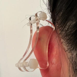 Brincos De Compressão Quelóide Clinicamente Projetado Doutor-Guiado Para Eficaz Relaxante Tratamento De Ouvido Healthcare Supply - Product Image 4