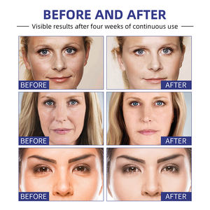 Marque privée Crème pour le <span class=keywords><strong>visage</strong></span> pour les soins <span class=keywords><strong>de</strong></span> la peau Lifting Neck Night Day Wrinkle Remover Firming Face Cream - Product Image 3