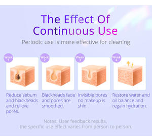 Nouvelle machine faciale 6 en 1, apaise et répare, resserre les pores, hydro-dermabrasion, machine de soin de la peau pour salon de beauté - Product Image 4