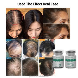 Siero per il Cuoio Capelluto per <span class=keywords><strong>Capelli</strong></span> Diradati e Calvi, Tonico per la Crescita, Siero Anticaduta, Alopecia, EXO Liofilizzato per la Ricrescita dei <span class=keywords><strong>Capelli</strong></span> - Product Image 3