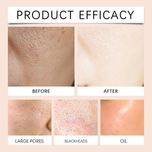 Gel exfoliant doux purifiant en marque propre 50g Nettoyage en profondeur Hydratant Convient à tous les types de peau Soins quotidiens du visage - Product Image 6